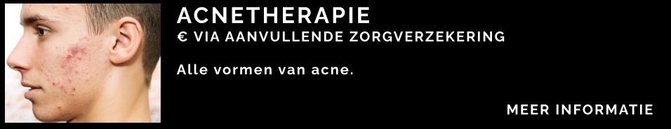 ACNETHERAPIE  € VIA AANVULLENDE ZORGVERZEKERING  Alle vormen van acne.  MEER INFORMATIE