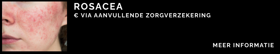 ROSACEA € VIA AANVULLENDE ZORGVERZEKERING   MEER INFORMATIE