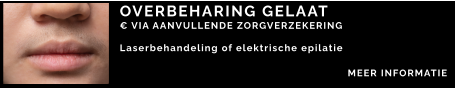 OVERBEHARING GELAAT € VIA AANVULLENDE ZORGVERZEKERING  Laserbehandeling of elektrische epilatie    MEER INFORMATIE