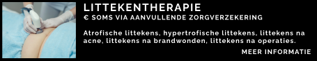 LITTEKENTHERAPIE € SOMS VIA AANVULLENDE ZORGVERZEKERING  Atrofische littekens, hypertrofische littekens, littekens na acne, littekens na brandwonden, littekens na operaties.  MEER INFORMATIE