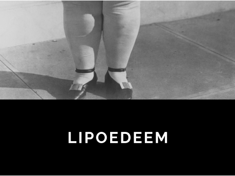 LIPOEDEEM