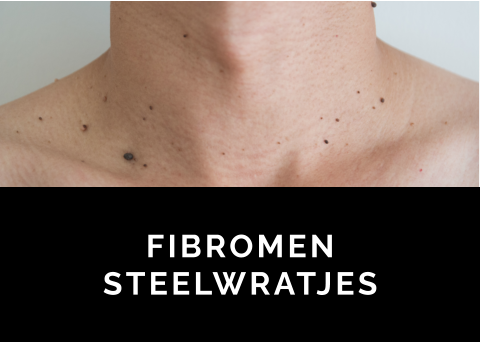 FIBROMEN STEELWRATJES FIBROMEN STEELWRATJES